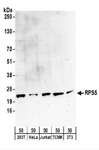 RPS5 / Ribosomal Protein S5 Antibody - Detection of Human and Mouse RPS5 by Western Blot. Samples: Whole cell lysate (50 ug) from 293T, HeLa, Jurkat, mouse TCMK-1, and mouse NIH3T3 cells. Antibodies: Affinity purified rabbit anti-RPS5 antibody used for WB at 0.4 ug/ml. Detection: Chemiluminescence with an exposure time of 3 minutes.