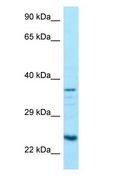 RPS5 / Ribosomal Protein S5 Antibody - RPS5 antibody Western Blot of HCT15.  This image was taken for the unconjugated form of this product. Other forms have not been tested.