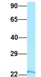 RPS5 / Ribosomal Protein S5 Antibody - RPS5 antibody Western Blot of 293T lysate. Antibody Dilution: 1.0 ug/ml. RPS5 is supported by BioGPS gene expression data to be expressed in HEK293T. Antibody dilution: 1 ug/ml.  This image was taken for the unconjugated form of this product. Other forms have not been tested.