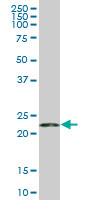 RPS5 / Ribosomal Protein S5 Antibody - RPS5 monoclonal antibody (M01), clone 3G3. Western blot of RPS5 expression in HeLa.