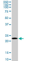 RPS5 / Ribosomal Protein S5 Antibody - RPS5 monoclonal antibody (M01), clone 3G3. Western blot of RPS5 expression in PC-12.