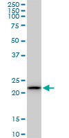 RPS5 / Ribosomal Protein S5 Antibody - RPS5 monoclonal antibody (M01), clone 3G3. Western blot of RPS5 expression in Raw 264.7.