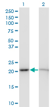 RPS5 / Ribosomal Protein S5 Antibody - Western blot of RPS5 expression in transfected 293T cell line by RPS5 monoclonal antibody (M01), clone 3G3.
