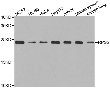 RPS5 / Ribosomal Protein S5 Antibody - Western blot analysis of extracts of various cell lines.