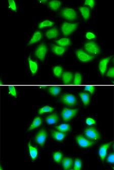 RPS5 / Ribosomal Protein S5 Antibody - Immunofluorescence analysis of U20S cells.