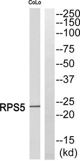 RPS5 / Ribosomal Protein S5 Antibody - Western blot of extracts from COLO cells, using RPS5 antibody.