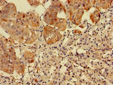 RPS5 / Ribosomal Protein S5 Antibody - Immunohistochemistry of paraffin-embedded human adrenal gland tissue at dilution of 1:100