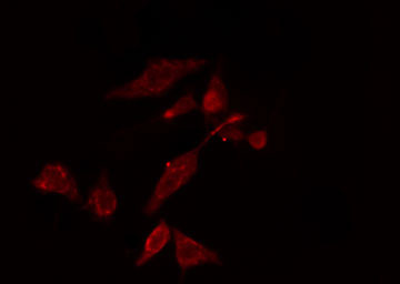 RPS5 / Ribosomal Protein S5 Antibody - Staining COLO cells by IF/ICC. The samples were fixed with PFA and permeabilized in 0.1% Triton X-100, then blocked in 10% serum for 45 min at 25°C. The primary antibody was diluted at 1:200 and incubated with the sample for 1 hour at 37°C. An Alexa Fluor 594 conjugated goat anti-rabbit IgG (H+L) antibody, diluted at 1/600, was used as secondary antibody.