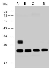 RPS5 / Ribosomal Protein S5 Antibody - Anti-RPS5 rabbit polyclonal antibody at 1:500 dilution. Lane A: 293T Whole Cell Lysate. Lane B: Hela Whole Cell Lysate. Lane C: Jurkat Whole Cell Lysate. Lane D: HepG2 Whole Cell Lysate. Lysates/proteins at 30 ug per lane. Secondary: Goat Anti-Rabbit IgG (H+L)/HRP at 1/10000 dilution. Developed using the ECL technique. Performed under reducing conditions. Predicted band size: 23 kDa. Observed band size: 23 kDa. (We are unsure as to the identity of these extra bands.)