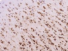 RPS5 / Ribosomal Protein S5 Antibody - Immunochemical staining of human RPS5 in human brain with rabbit polyclonal antibody at 1:200 dilution, formalin-fixed paraffin embedded sections.