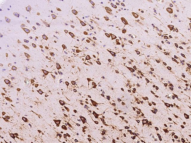 RPS5 / Ribosomal Protein S5 Antibody - Immunochemical staining of human RPS5 in human brain with rabbit polyclonal antibody at 1:200 dilution, formalin-fixed paraffin embedded sections.