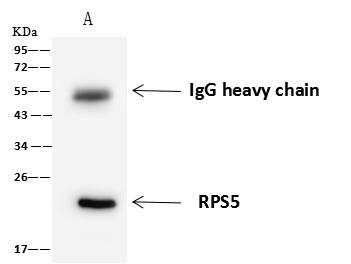 RPS5 / Ribosomal Protein S5 Antibody - RPS5 was immunoprecipitated using: Lane A: 0.5 mg 293T Whole Cell Lysate. 4 uL anti-RPS5 rabbit polyclonal antibody and 60 ug of Immunomagnetic beads Protein A/G. Primary antibody: Anti-RPS5 rabbit polyclonal antibody, at 1:100 dilution. Secondary antibody: Goat Anti-Rabbit IgG (H+L)/HRP at 1/10000 dilution. Developed using the ECL technique. Performed under reducing conditions. Predicted band size: 23 kDa. Observed band size: 23 kDa.
