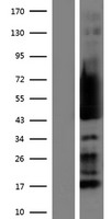 RPS5 / Ribosomal Protein S5 Protein - Western validation with an anti-DDK antibody * L: Control HEK293 lysate R: Over-expression lysate