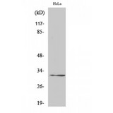 RPS6 / Ribosomal Protein S6 Antibody - Western blot of Ribosomal Protein S6 antibody
