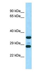 RPS6 / Ribosomal Protein S6 Antibody - RPS6 / S6 antibody Western Blot of Rat Muscle.  This image was taken for the unconjugated form of this product. Other forms have not been tested.