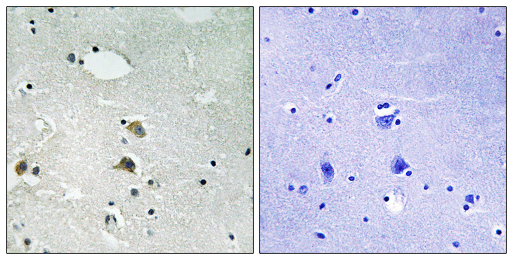 RPS6 / Ribosomal Protein S6 Antibody - Immunohistochemistry analysis of paraffin-embedded human brain tissue, using S6 Ribosomal Protein Antibody. The picture on the right is blocked with the synthesized peptide.