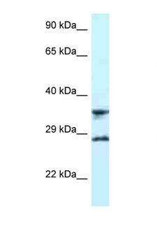 RPS6 / Ribosomal Protein S6 Antibody - RPS6 antibody Western blot of U937 Cell lysate. Antibody concentration 1 ug/ml.  This image was taken for the unconjugated form of this product. Other forms have not been tested.
