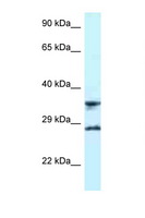 RPS6 / Ribosomal Protein S6 Antibody - RPS6 antibody Western blot of U937 Cell lysate. Antibody concentration 1 ug/ml.  This image was taken for the unconjugated form of this product. Other forms have not been tested.