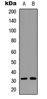 RPS6 / Ribosomal Protein S6 Antibody - Western blot analysis of RPS6 (pS240) expression in Jurkat Anisomycin-treated (A); SKOV3 (B) whole cell lysates.