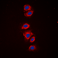 RPS6 / Ribosomal Protein S6 Antibody - Immunofluorescent analysis of RPS6 (pS240) staining in HeLa cells. Formalin-fixed cells were permeabilized with 0.1% Triton X-100 in TBS for 5-10 minutes and blocked with 3% BSA-PBS for 30 minutes at room temperature. Cells were probed with the primary antibody in 3% BSA-PBS and incubated overnight at 4 deg C in a humidified chamber. Cells were washed with PBST and incubated with a DyLight 594-conjugated secondary antibody (red) in PBS at room temperature in the dark. DAPI was used to stain the cell nuclei (blue).