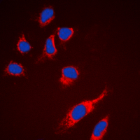 RPS6 / Ribosomal Protein S6 Antibody - Immunofluorescent analysis of RPS6 staining in DU145 cells. Formalin-fixed cells were permeabilized with 0.1% Triton X-100 in TBS for 5-10 minutes and blocked with 3% BSA-PBS for 30 minutes at room temperature. Cells were probed with the primary antibody in 3% BSA-PBS and incubated overnight at 4 deg C in a humidified chamber. Cells were washed with PBST and incubated with a DyLight 594-conjugated secondary antibody (red) in PBS at room temperature in the dark. DAPI was used to stain the cell nuclei (blue).