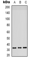 RPS6 / Ribosomal Protein S6 Antibody - Western blot analysis of RPS6 expression in HeLa (A); mouse liver (B); K562 (C) whole cell lysates.