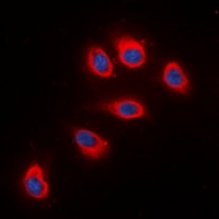 RPS6 / Ribosomal Protein S6 Antibody - Immunofluorescent analysis of RPS6 staining in HeLa cells. Formalin-fixed cells were permeabilized with 0.1% Triton X-100 in TBS for 5-10 minutes and blocked with 3% BSA-PBS for 30 minutes at room temperature. Cells were probed with the primary antibody in 3% BSA-PBS and incubated overnight at 4 deg C in a humidified chamber. Cells were washed with PBST and incubated with a DyLight 594-conjugated secondary antibody (red) in PBS at room temperature in the dark. DAPI was used to stain the cell nuclei (blue).