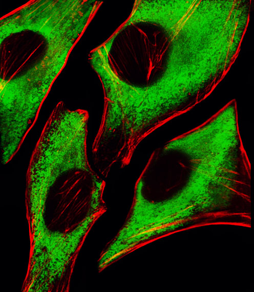 RPS6 / Ribosomal Protein S6 Antibody - Fluorescent image of HeLa cells stained with RPS6 Antibody. Antibody was diluted at 1:25 dilution. An Alexa Fluor 488-conjugated goat anti-mouse lgG at 1:400 dilution was used as the secondary antibody (green). Cytoplasmic actin was counterstained with Alexa Fluor 555 conjugated with Phalloidin (red).