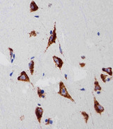 RPS6 / Ribosomal Protein S6 Antibody - Immunohistochemical of paraffin-embedded H. brain section using RPS6 Antibody. Antibody was diluted at 1:25 dilution. A peroxidase-conjugated goat anti-rabbit IgG at 1:400 dilution was used as the secondary antibody, followed by DAB staining.
