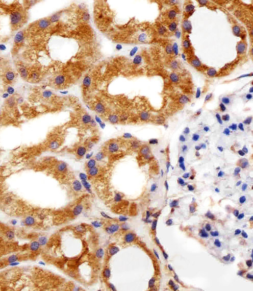 RPS6 / Ribosomal Protein S6 Antibody - Immunohistochemical of paraffin-embedded H. kidney section using RPS6 Antibody. Antibody was diluted at 1:25 dilution. A peroxidase-conjugated goat anti-rabbit IgG at 1:400 dilution was used as the secondary antibody, followed by DAB staining.
