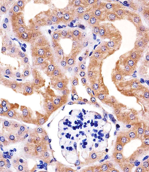 RPS6 / Ribosomal Protein S6 Antibody - Immunohistochemical of paraffin-embedded M. kidney section using RPS6 Antibody. Antibody was diluted at 1:25 dilution. A peroxidase-conjugated goat anti-rabbit IgG at 1:400 dilution was used as the secondary antibody, followed by DAB staining.