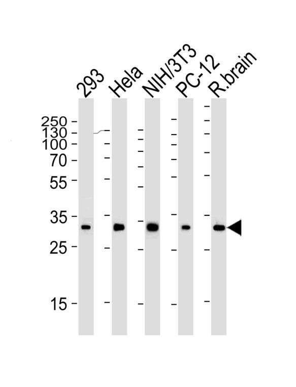 RPS6 / Ribosomal Protein S6 Antibody - Western blot of lysates from 293, HeLa, mouse NIH/3T3, rat PC-12 cell line and rat brain tissue lysate (from left to right) with RPS6 Antibody. Antibody was diluted at 1:2000 at each lane. A goat anti-mouse IgG H&L (HRP) at 1:3000 dilution was used as the secondary antibody. Lysates at 35 ug per lane.