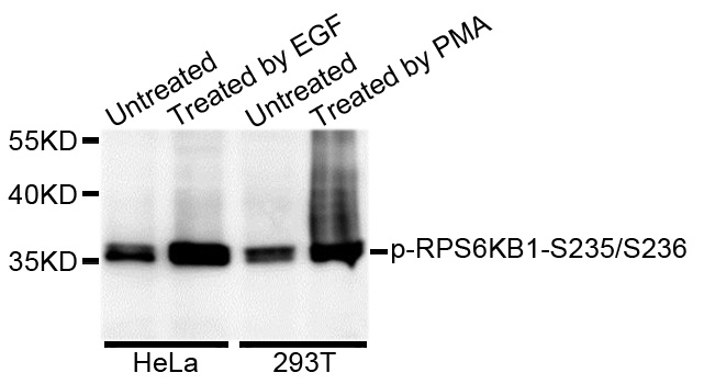 RPS6 / Ribosomal Protein S6 Antibody - Western blot analysis of extracts of various cell lines.