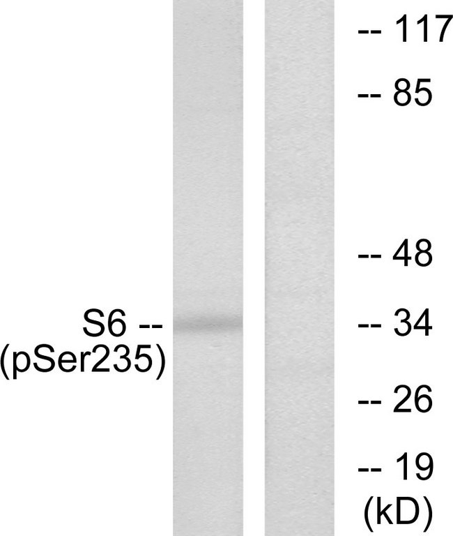 RPS6 / Ribosomal Protein S6 Antibody - Western blot analysis of lysates from 293 cells treated with serum 10% 15', using S6 Ribosomal Protein (Phospho-Ser235) Antibody. The lane on the right is blocked with the phospho peptide.