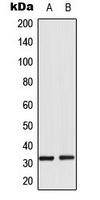 RPS6 / Ribosomal Protein S6 Antibody - Western blot analysis of RPS6 (pS235) expression in HeLa Calyculin A-treated (A); NIH3T3 (B) whole cell lysates.