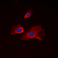 RPS6 / Ribosomal Protein S6 Antibody - Immunofluorescent analysis of RPS6 (pS235) staining in NIH3T3 cells. Formalin-fixed cells were permeabilized with 0.1% Triton X-100 in TBS for 5-10 minutes and blocked with 3% BSA-PBS for 30 minutes at room temperature. Cells were probed with the primary antibody in 3% BSA-PBS and incubated overnight at 4 C in a humidified chamber. Cells were washed with PBST and incubated with a DyLight 594-conjugated secondary antibody (red) in PBS at room temperature in the dark. DAPI was used to stain the cell nuclei (blue).