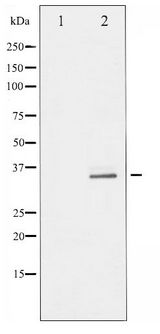 RPS6 / Ribosomal Protein S6 Antibody - Western blot of S6 Ribosomal Protein phosphorylation expression in serum treated 293 whole cell lysates,The lane on the left is treated with the antigen-specific peptide.