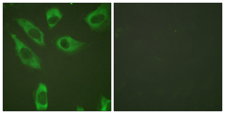 RPS6 / Ribosomal Protein S6 Antibody - Immunofluorescence analysis of HeLa cells, using S6 Ribosomal Protein (Phospho-Ser240) Antibody. The picture on the right is blocked with the phospho peptide.