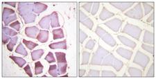 RPS6 / Ribosomal Protein S6 Antibody - Immunohistochemistry analysis of paraffin-embedded human skeletal muscle, using S6 Ribosomal Protein (Phospho-Ser240) Antibody. The picture on the right is blocked with the phospho peptide.