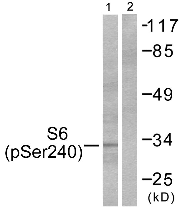 RPS6 / Ribosomal Protein S6 Antibody - Western blot analysis of extracts from HeLa cells, treated with TNF-a (20ng/ml, 2mins), using S6 Ribosomal Protein (Phospho-Ser240) antibody.
