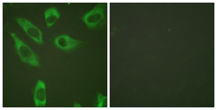 RPS6 / Ribosomal Protein S6 Antibody - P-peptide - + Immunofluorescence analysis of HeLa cells, using S6 Ribosomal Protein (Phospho-Ser240) antibody.