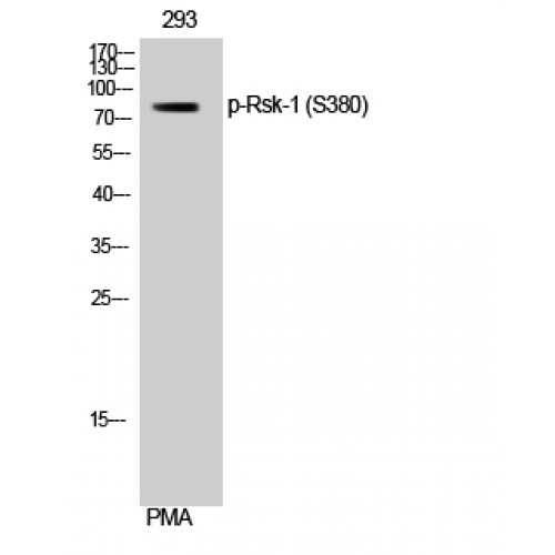 RPS6KA1 / RSK1 Antibody - Western blot of Phospho-Rsk-1 (S380) antibody