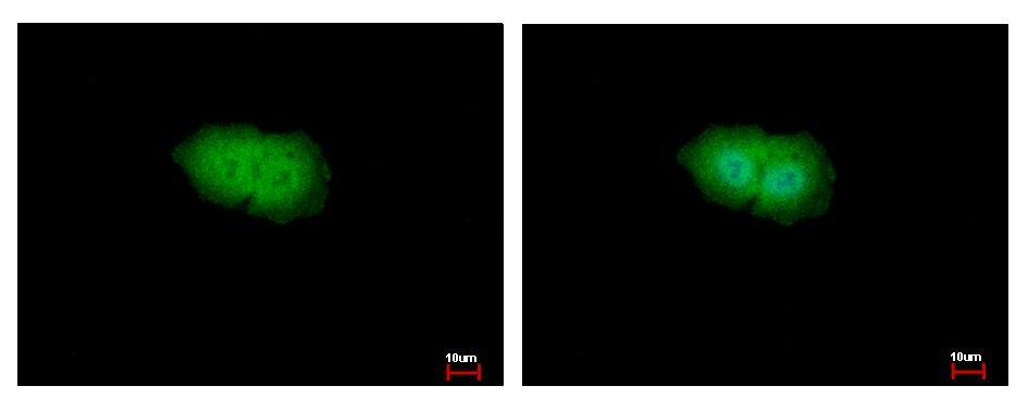 RPS6KA1 / RSK1 Antibody - RSK1 antibody detects RSK1 p90 protein at Cytoplasm and Nucleus by immunofluorescent analysis. HepG2 cells were fixed in 4% paraformaldehyde at RT for 15 min. RSK1 p90 protein stained by RSK1 antibody diluted at 1:500. 