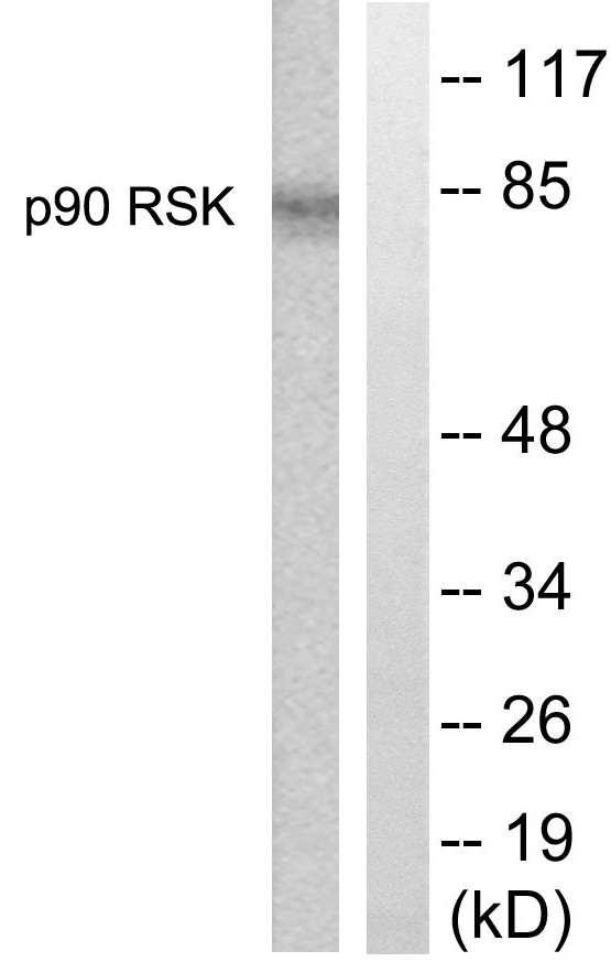 RPS6KA1 / RSK1 Antibody - Western blot analysis of lysates from 293 cells, treated with PMA 125ng/ml 30', using p90 RSK Antibody. The lane on the right is blocked with the synthesized peptide.