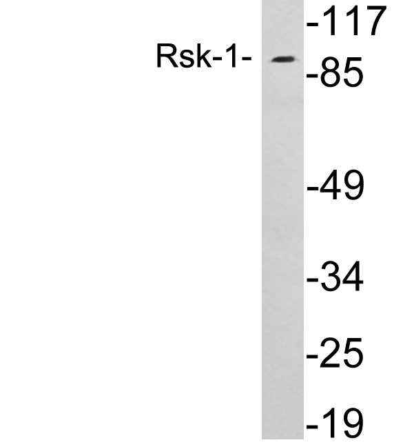 RPS6KA1 / RSK1 Antibody - Western blot analysis of lysates from 293 cells, using Rsk-1 antibody.