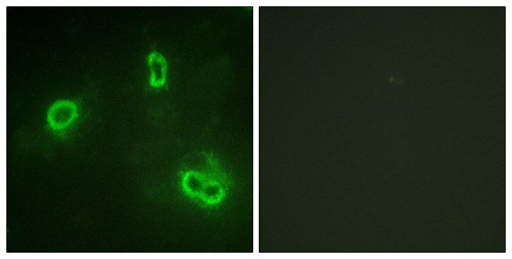 RPS6KA1 / RSK1 Antibody - Immunofluorescence analysis of COS7 cells, using p90 RSK Antibody. The picture on the right is blocked with the synthesized peptide.