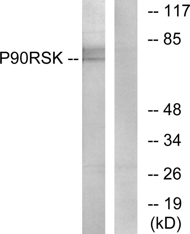 RPS6KA1 / RSK1 Antibody - Western blot analysis of lysates from NIH/3T3 cells, treated with PMA 125ng/ml 30', using p90 RSK Antibody. The lane on the right is blocked with the synthesized peptide.