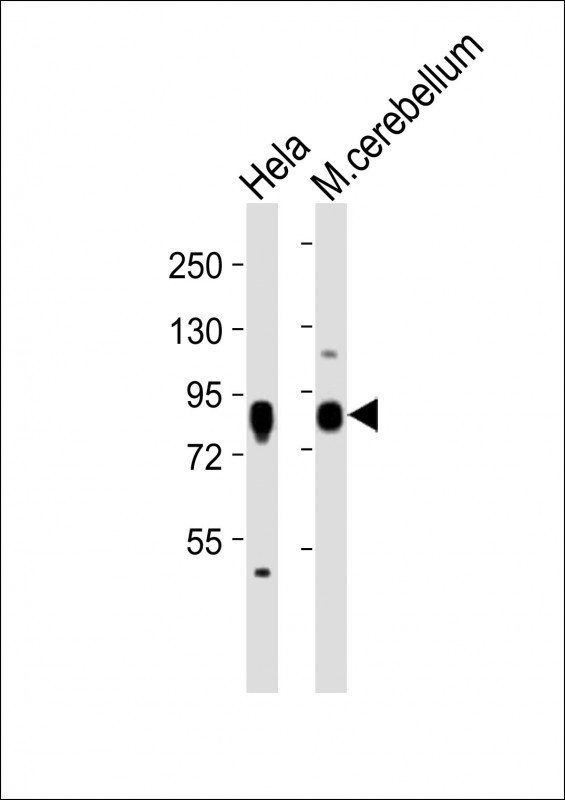RPS6KA1 / RSK1 Antibody - All lanes : Anti-Rps6ka1 Antibody at 1:2000 dilution Lane 1: HeLa whole cell lysates Lane 2: mouse cerebellum lysates Lysates/proteins at 20 ug per lane. Secondary Goat Anti-Rabbit IgG, (H+L), Peroxidase conjugated at 1/10000 dilution Predicted band size : 82 kDa Blocking/Dilution buffer: 5% NFDM/TBST.