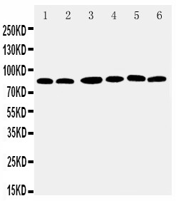 RPS6KA1 / RSK1 Antibody - WB of RPS6KA1 / RSK1 antibody. Lane 1: MCF-7 Cell Lysate. Lane 2: HELA Cell Lysate. Lane 3: K562 Cell Lysate. Lane 4: JURKAT Cell Lysate. Lane 5: SW620 Cell Lysate. Lane 6: RAJI Cell Lysate.