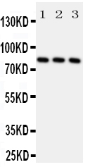 RPS6KA1 / RSK1 Antibody - Anti-RSK1 p90 antibody, All Western blotting All lanes: Anti-RPS6KA1 at 0.5ug/ml Lane 1: A431 Whole Cell Lysate at 40ug Lane 2: MCF-7 Whole Cell Lysate at 40ug Lane 3: HELA Whole Cell Lysate at 40ug Predicted bind size: 83KD Observed bind size: 83KD